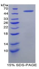 SDS-PAGE (CR2-836H).jpg